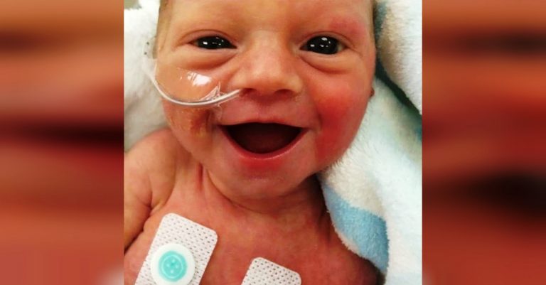 Preemie Baby With Beautiful Smile Gives Hope To Worried Parents