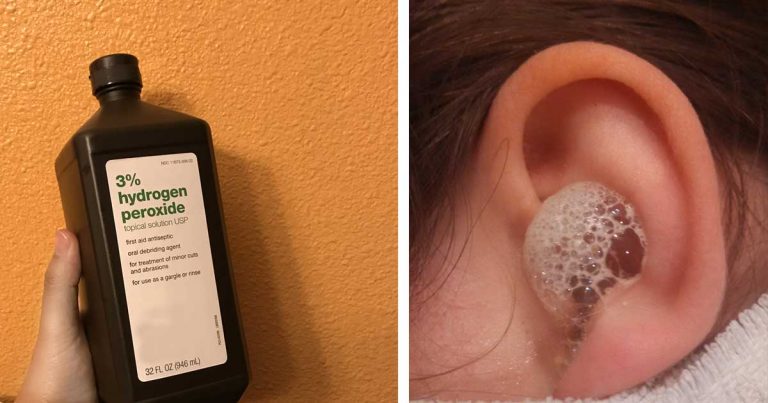 uses for hydrogen peroxide